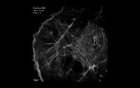 Nonlinear SIM of Cytoskeletal Dynamics