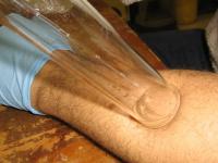 Forearm