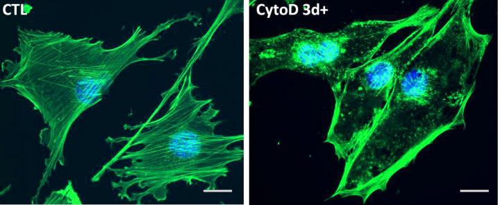 Actin Fibers