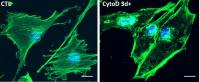 Actin Fibers