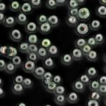 Ovarian Cancer Cells