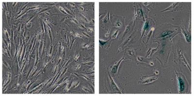 Salk Scientists Discover How a Protein in Werner's Syndrome Affects Aging