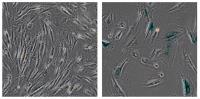 Salk Scientists Discover How a Protein in Werner's Syndrome Affects Aging