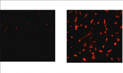 Activated Oncogene Spurs Production of Hydrogen Peroxide