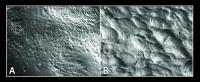 Image of Bone Remodeling