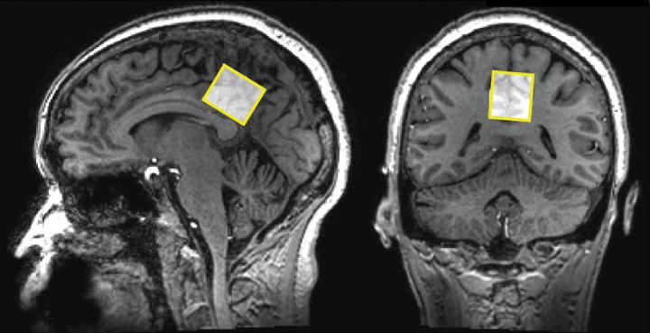 MRIs (2 of 2)