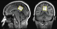 MRIs (2 of 2)