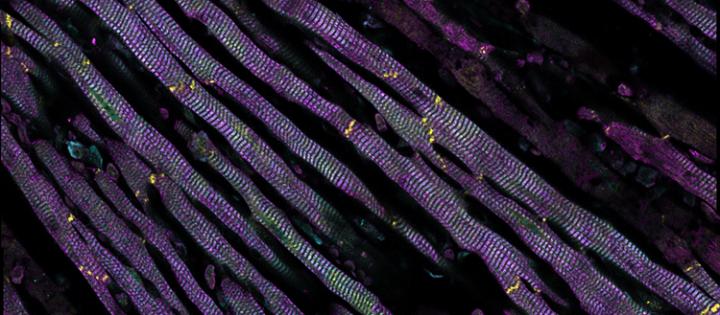 Immuno-Staining of Mouse Heart Cells under Anoxia