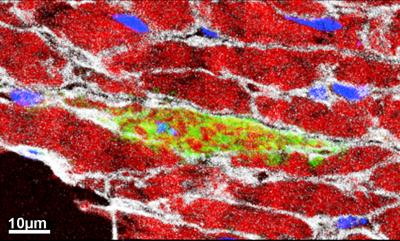 Heart Muscle Cells