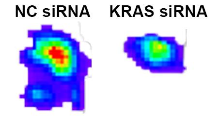 KRAS Image