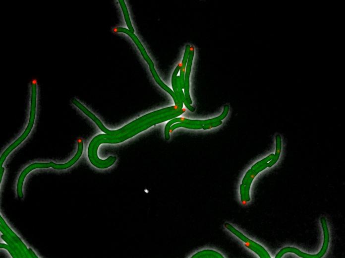 E. coli Cells Under Stress