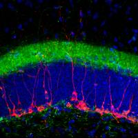 Staining for immature neuronal markers doublecortin (red) and calretinin (green)