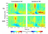 Movement-Related Oscillatory Changes