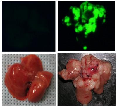 Mimicking Human Liver Cancer in Mouse
