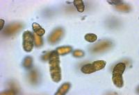 <i>Cochlodinium polykrikoides</i> (2 of 2)