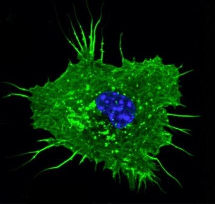 Dendritic Cell