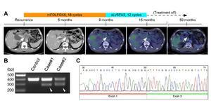 BRCA2:c.67G>C is associated with aberrant splicing and an exceptional response to platinum-based chemotherapy