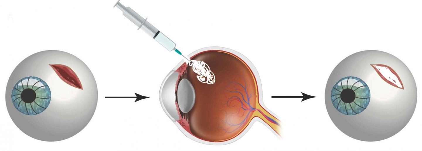 Hydrogel Seal Application Illustration