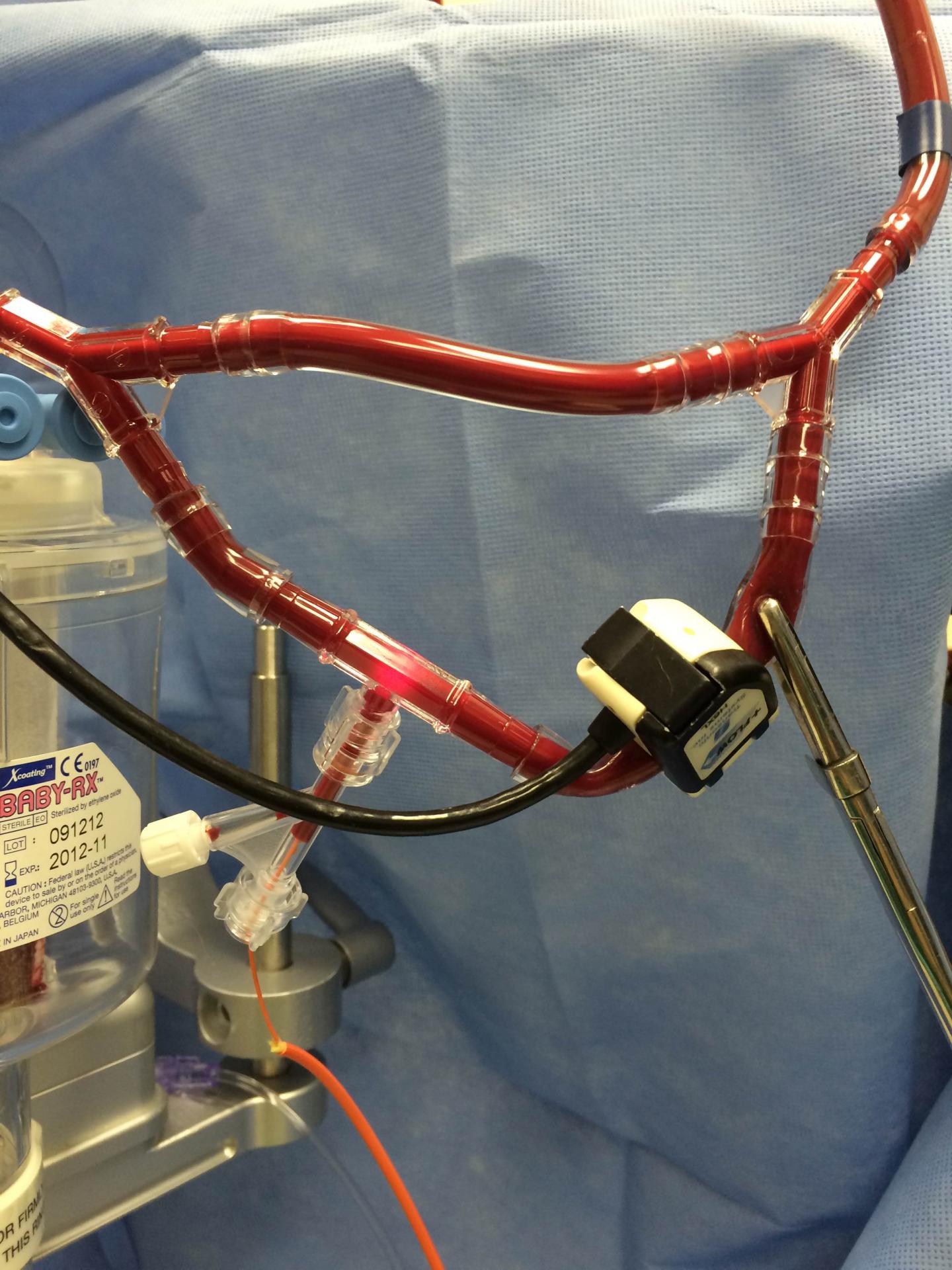 Blood Monitor 2