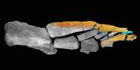 CT Scan