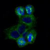 Abnormal Mitotic Spindles