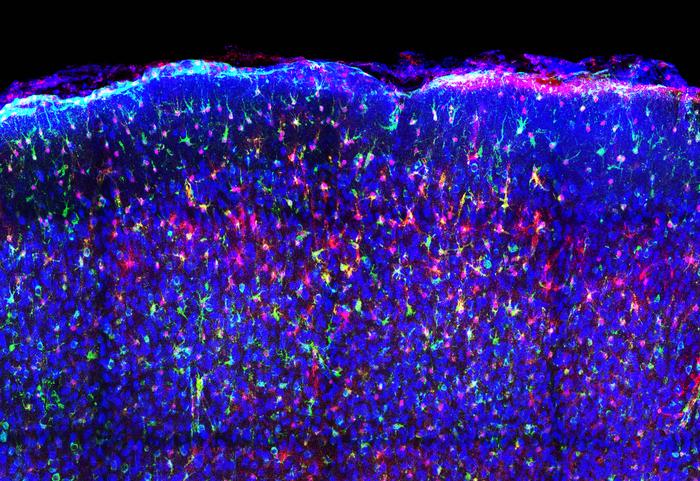 Mouse brain tissue, blue magenta green