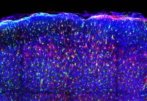 Mouse brain tissue, blue magenta green