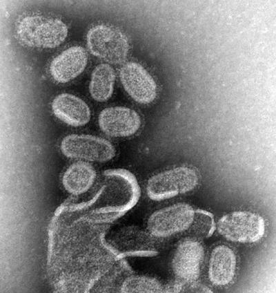 Hemagglutinin is Key to Human Flu Transmission