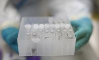 Covid-19 virus samples
