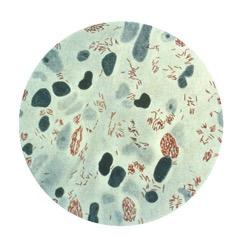 Immune Suppressant Ineffective in Treating Leprosy Inflammation
