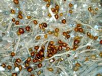 SCN Cysts