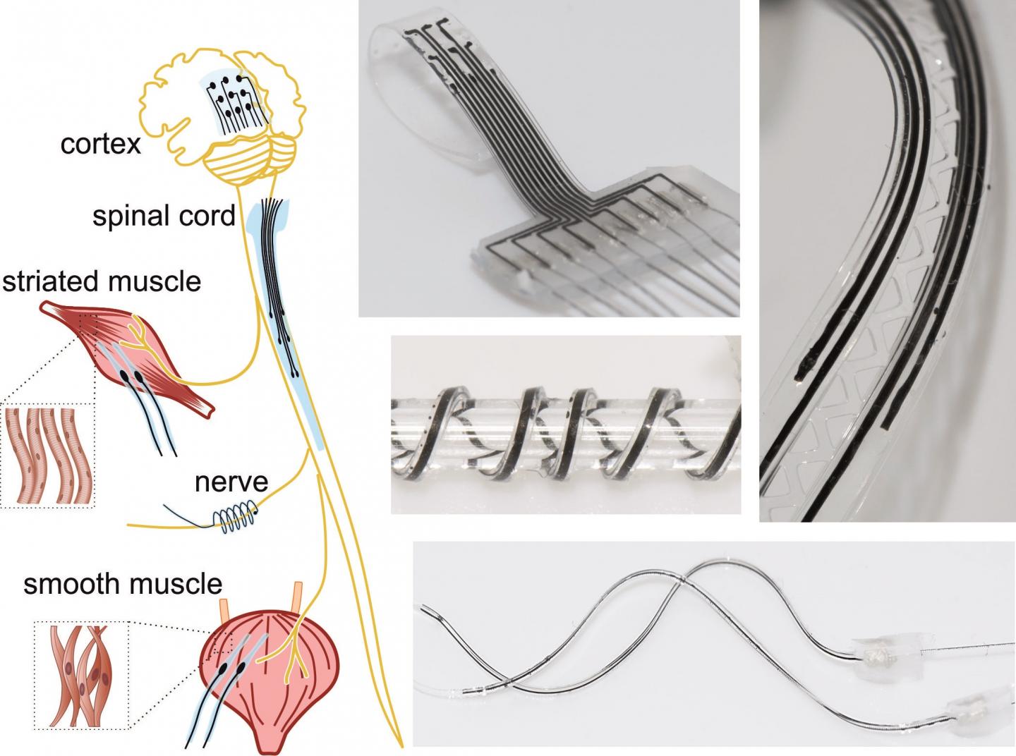 NeuroPrint