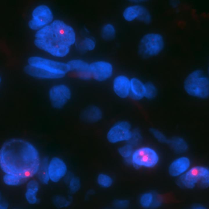 Telomeres