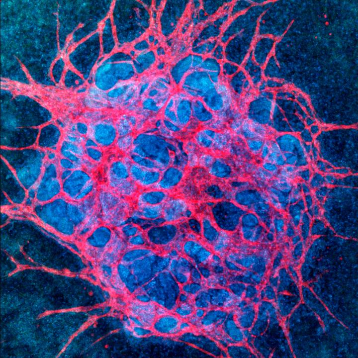 Vascularized Kidney Organoid