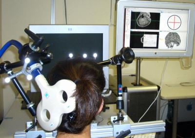 Research Subject Gets TMS