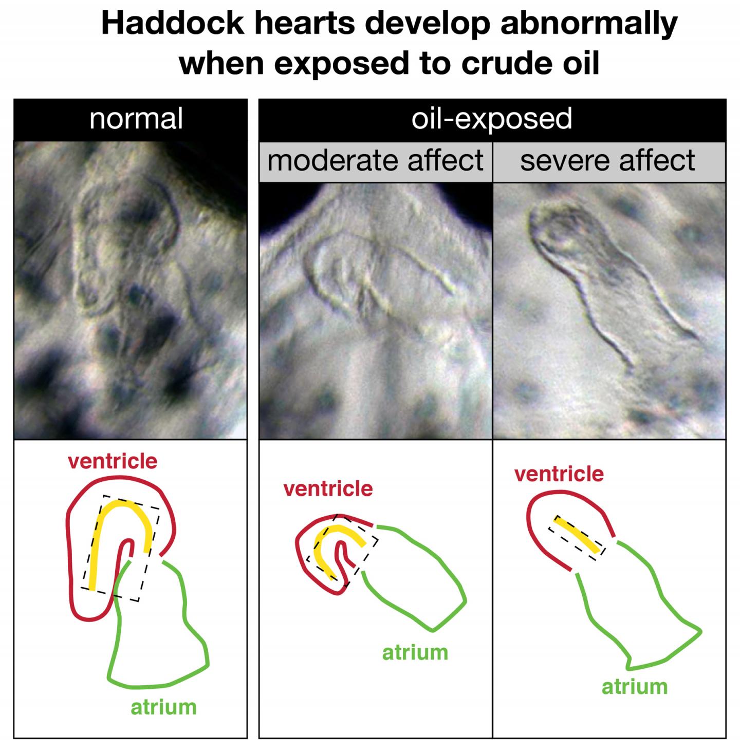 Haddock Heart Deformities Following Exposure to Crude Oil
