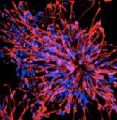 Nestin Immunoreactivity