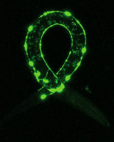 The Nervous System of the Ringworm