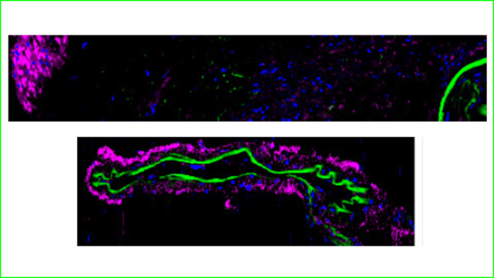 A potential therapeutic target to treat cerebral blood alterations