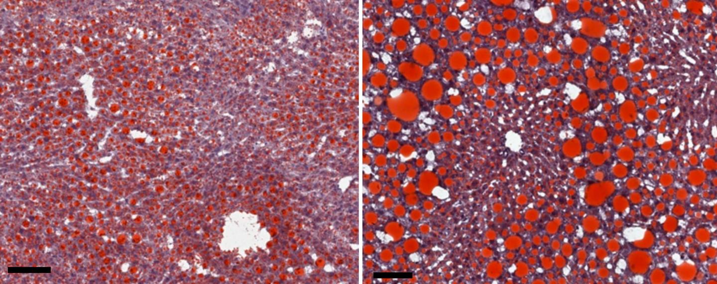 Mouse Livers