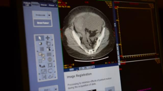 Simple CT Scanning Procedure