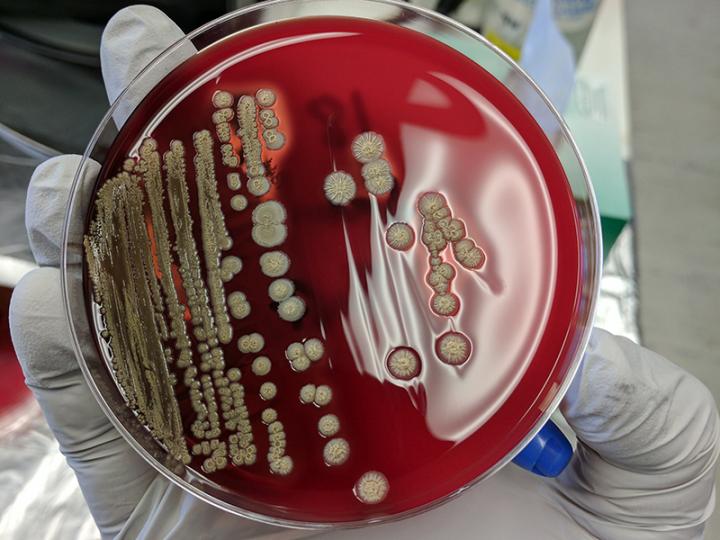 Petri dish
