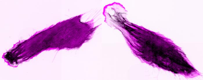 A fibroblast, a type of cell found in connective tissue and in the experiment, dyed pink on a white background.