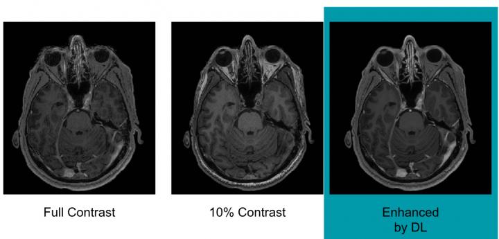 Images of Varying Doses of Gadolinium