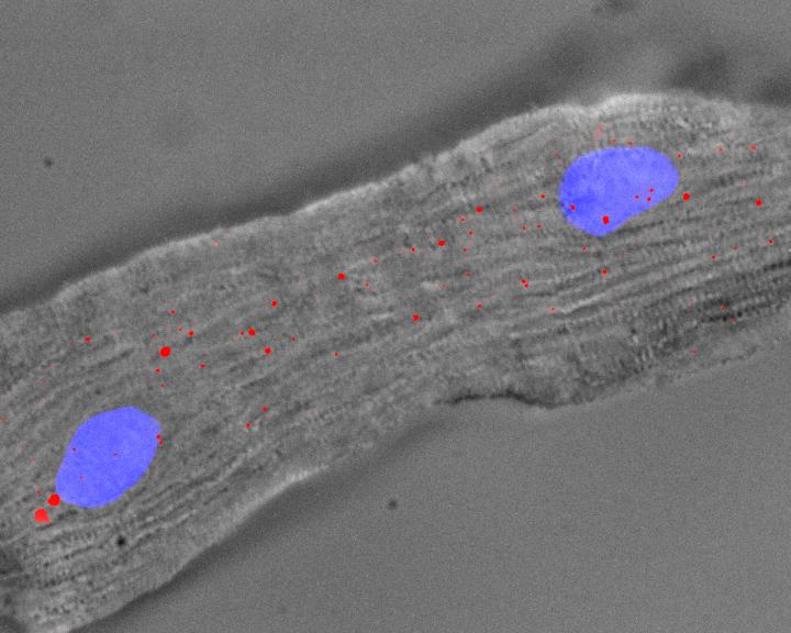 Singheart RNA