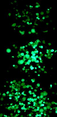 Cells Infected by the virus2