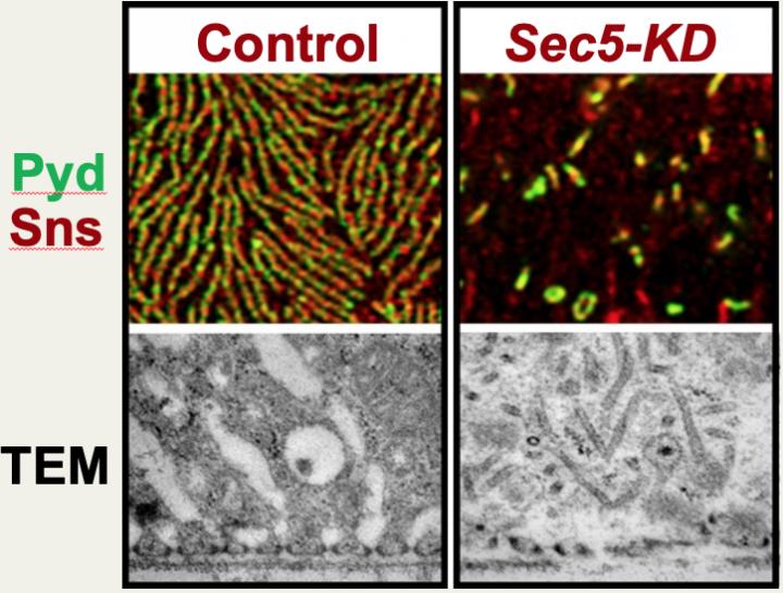 Certain Genes Essential for Proper Kidney Cell Function