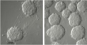 Insulin-Producing Cells