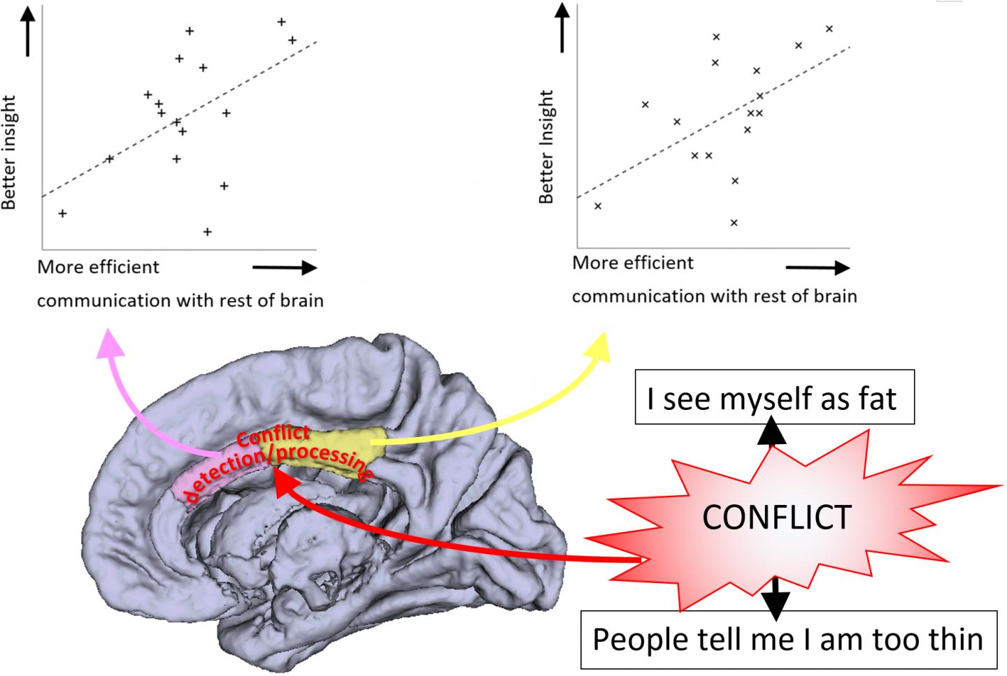 Brain