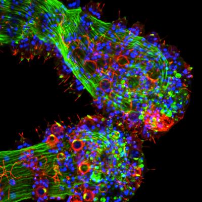 <I>Hydra magnipapillata</I> Tentacle Stained for Opsin